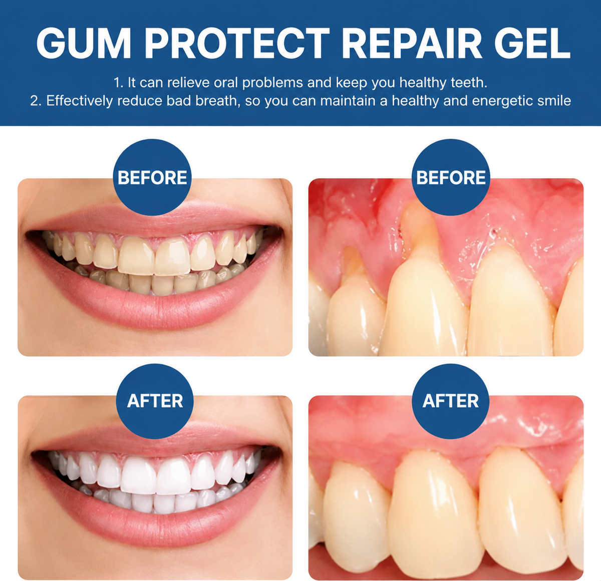 🦷 Noumise™ Teeth Repair Gel Stop bleeding gums — daily gum support.