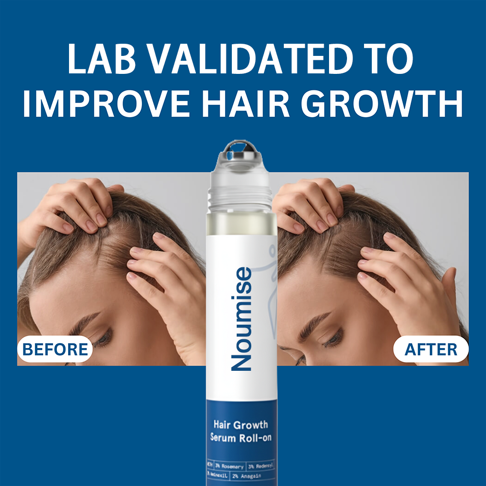 Noumise Hair Growth Roll on Serum