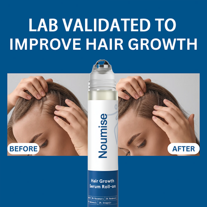 Noumise Hair Growth Roll on Serum