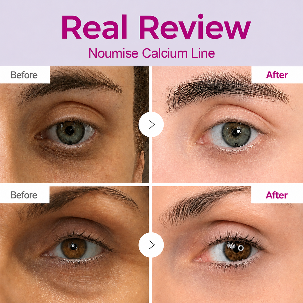 【OFFICIAL STORE】Noumise Korean Calcium Dark Spot Eye Cream