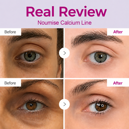 【OFFICIAL STORE】Noumise Korean Calcium Dark Spot Eye Cream