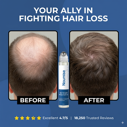 Noumise Hair Growth Roll on Serum