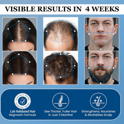 Noumise Hair Growth Roll on Serum
