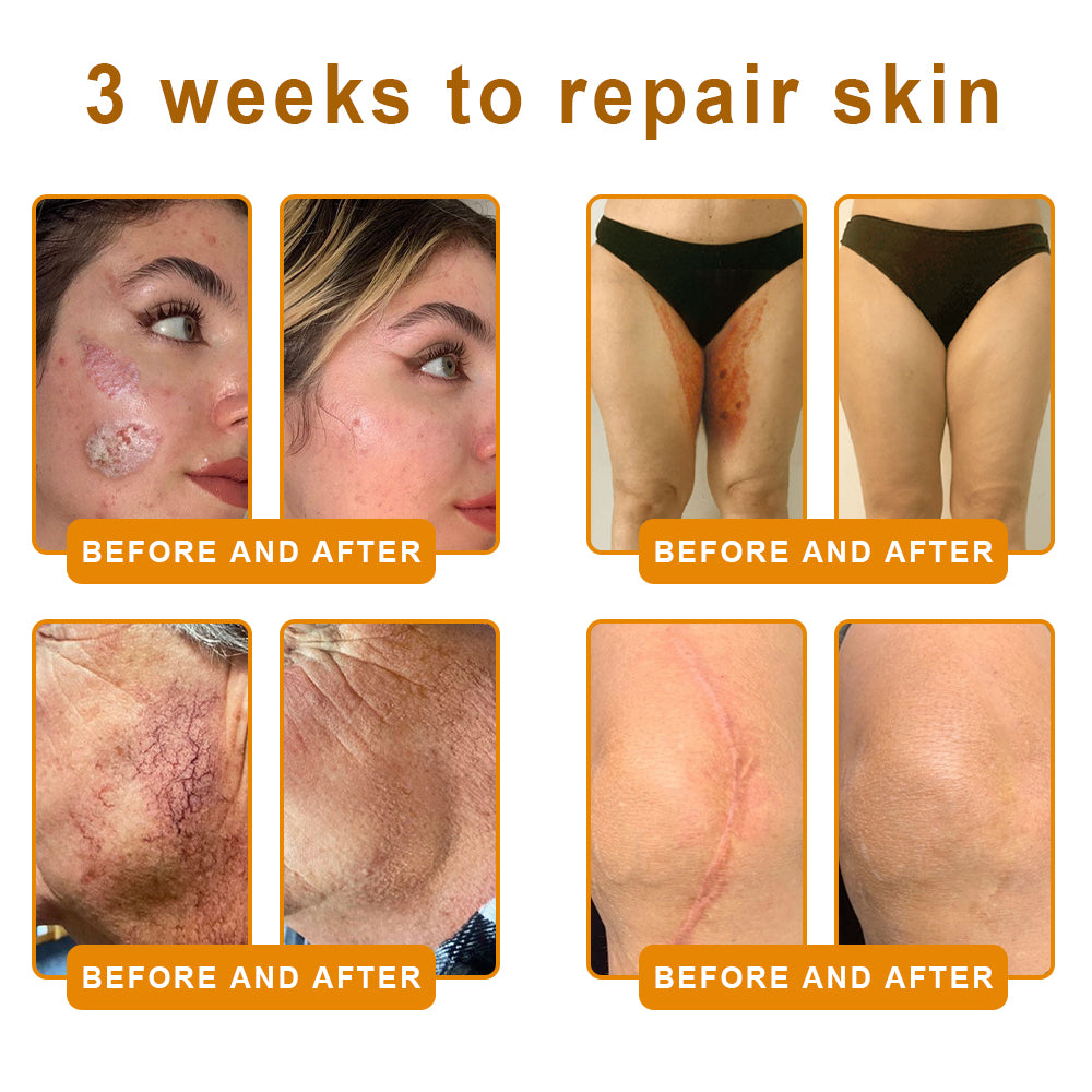 🔥Bee Extract Gentle Skin Renew Cream