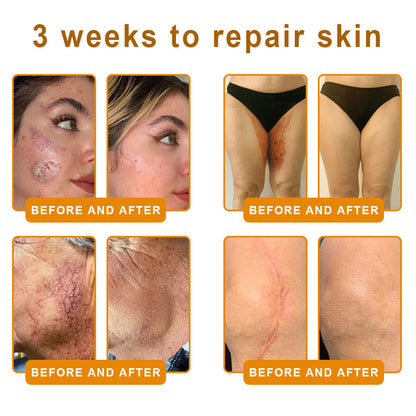 🔥Bee Extract Gentle Skin Renew Cream