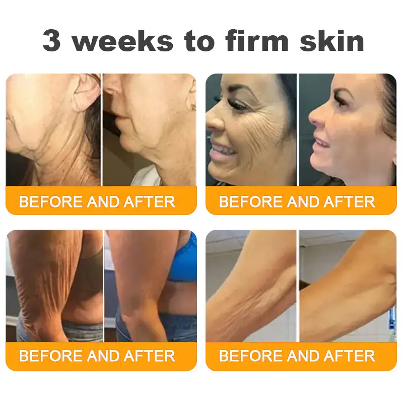 🔥Bee Extract Gentle Skin Renew Cream