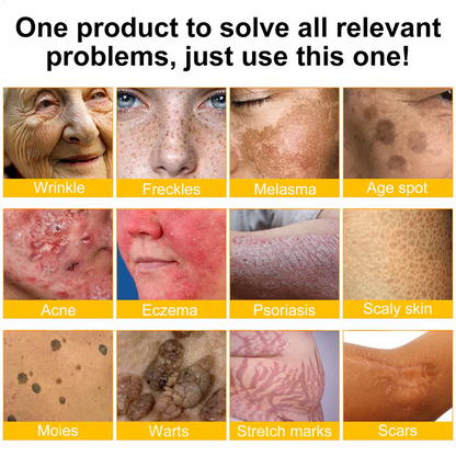 🔥Bee Extract Gentle Skin Renew Cream
