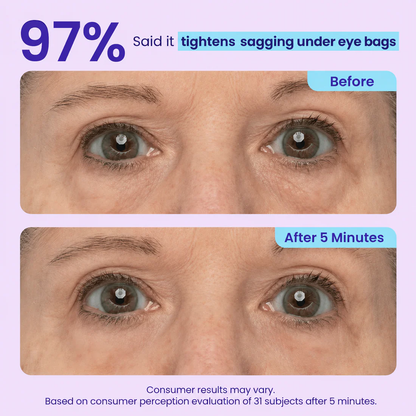 Noumise™ Instant Eye Tightener