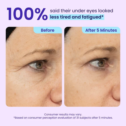 Noumise™ Instant Eye Tightener