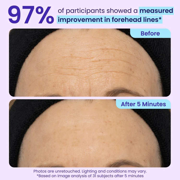 Noumise™ Instant Eye Tightener