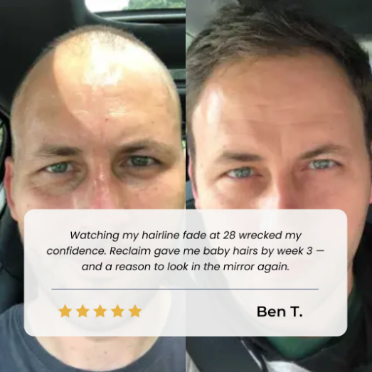 Noumise Hair Growth Roll on Serum