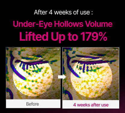 【OFFICIAL STORE】Noumise Korean Calcium Dark Spot Eye Cream